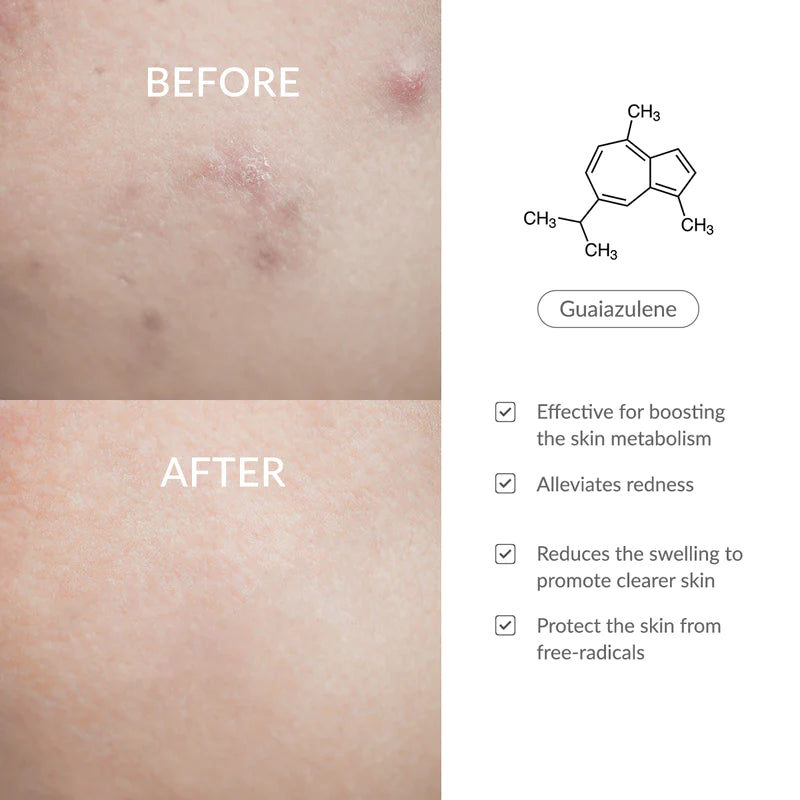 AZULENE 147HA INTENSIVE SOOTHING CREAM