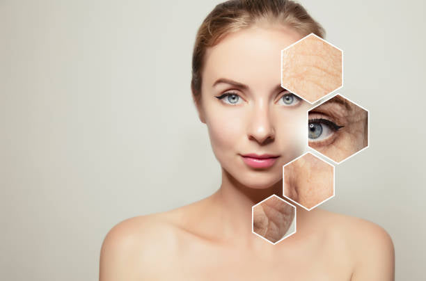 HIFU huidbehandeling Skin Clinic Ritterdam