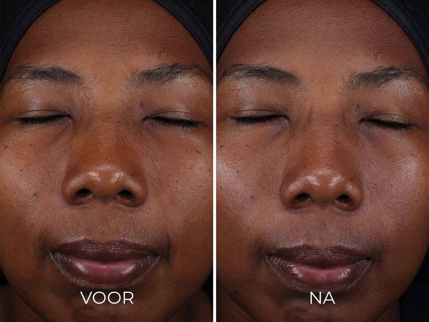 DAILY PREVENTION - Pure Mineral Tinted Moisturizer SPF 30