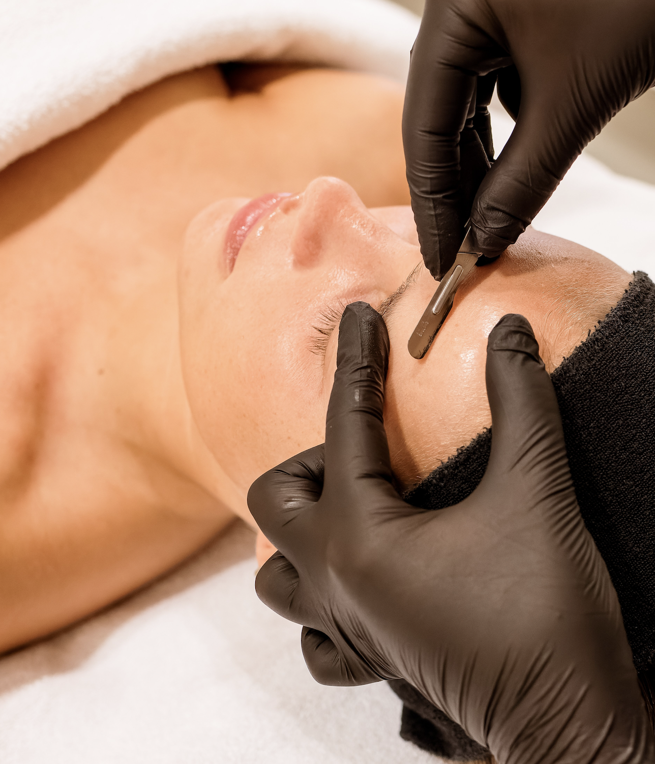Dermaplaning Skin Clinic Rotterdam