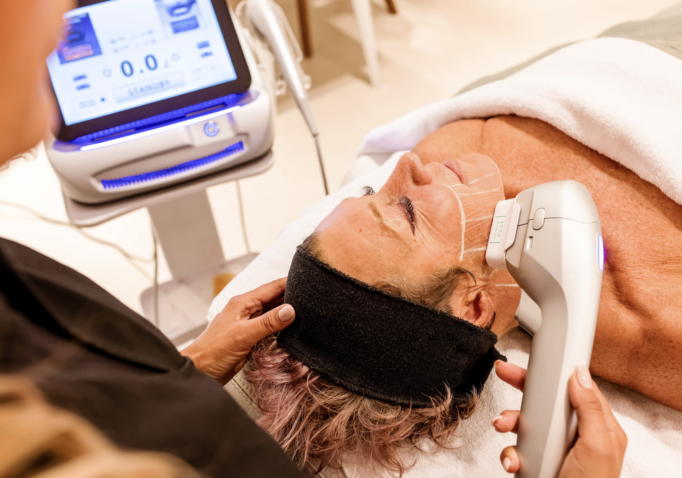 HIFU Huidversteviging Skin Clinic Rotterdam