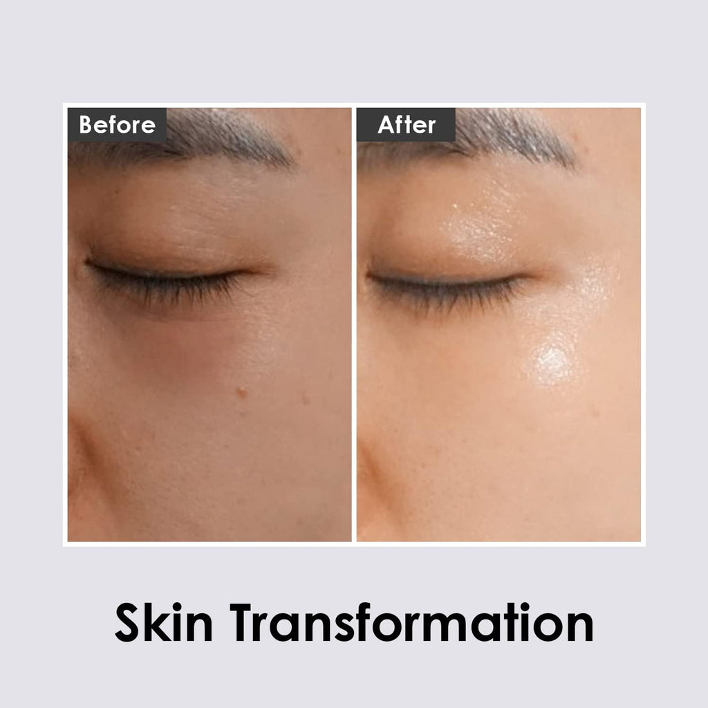Hyaluron Dark Benone 9 Ampoule Eye Patch